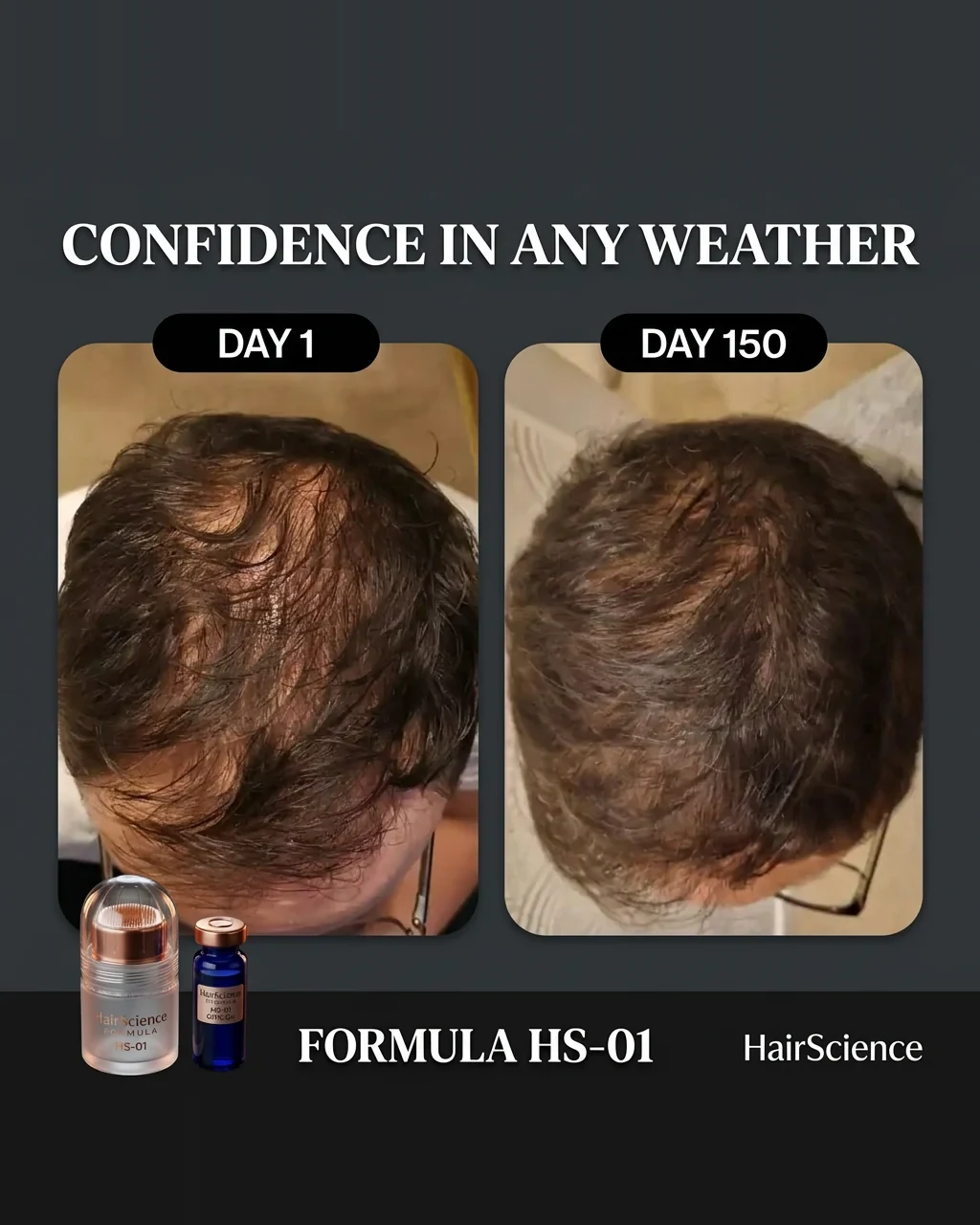 HairScience HS-01 winner ad — The Socially Anxious Man angle, gunmetal/copper kit creative