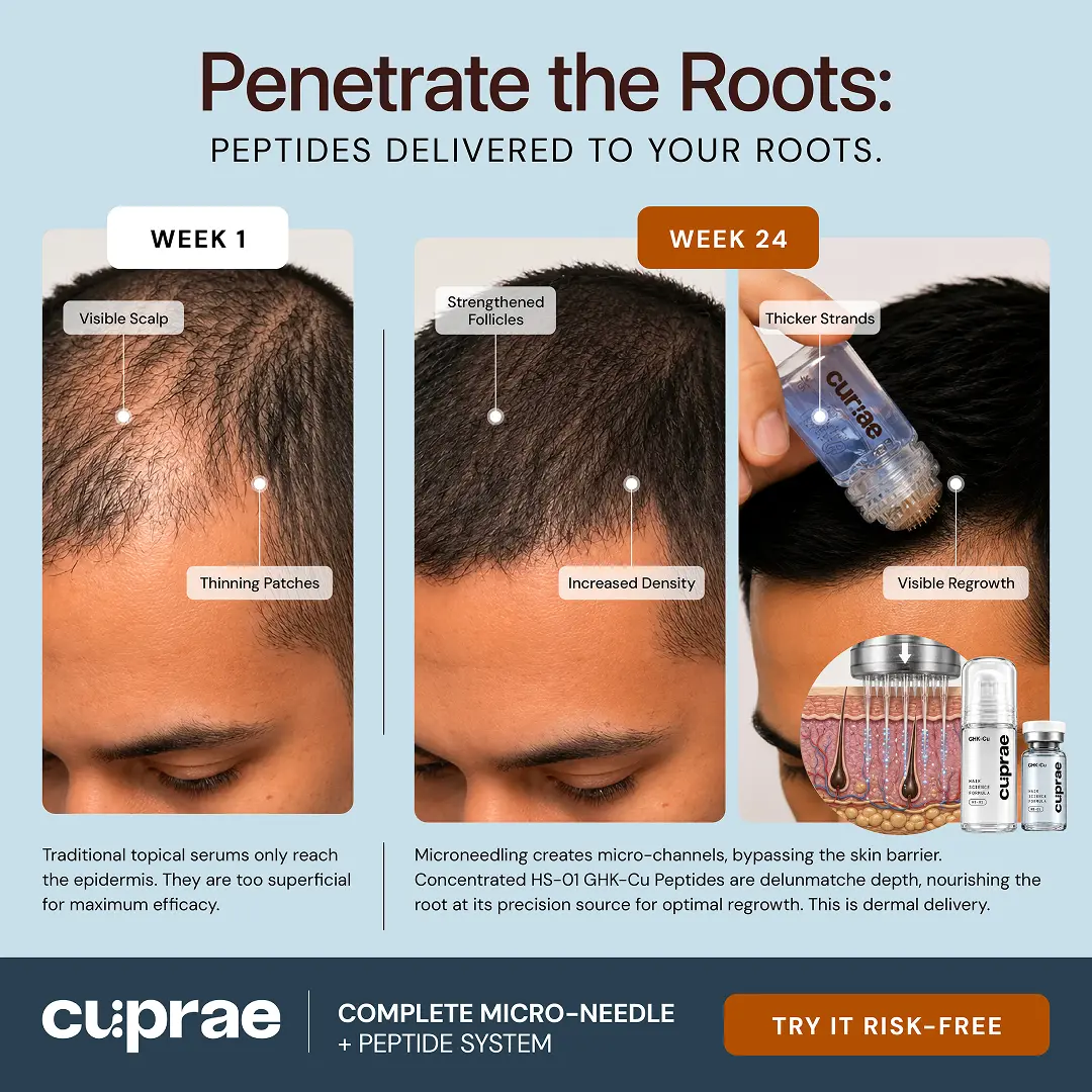 Cuprae micro-infusion device close-up