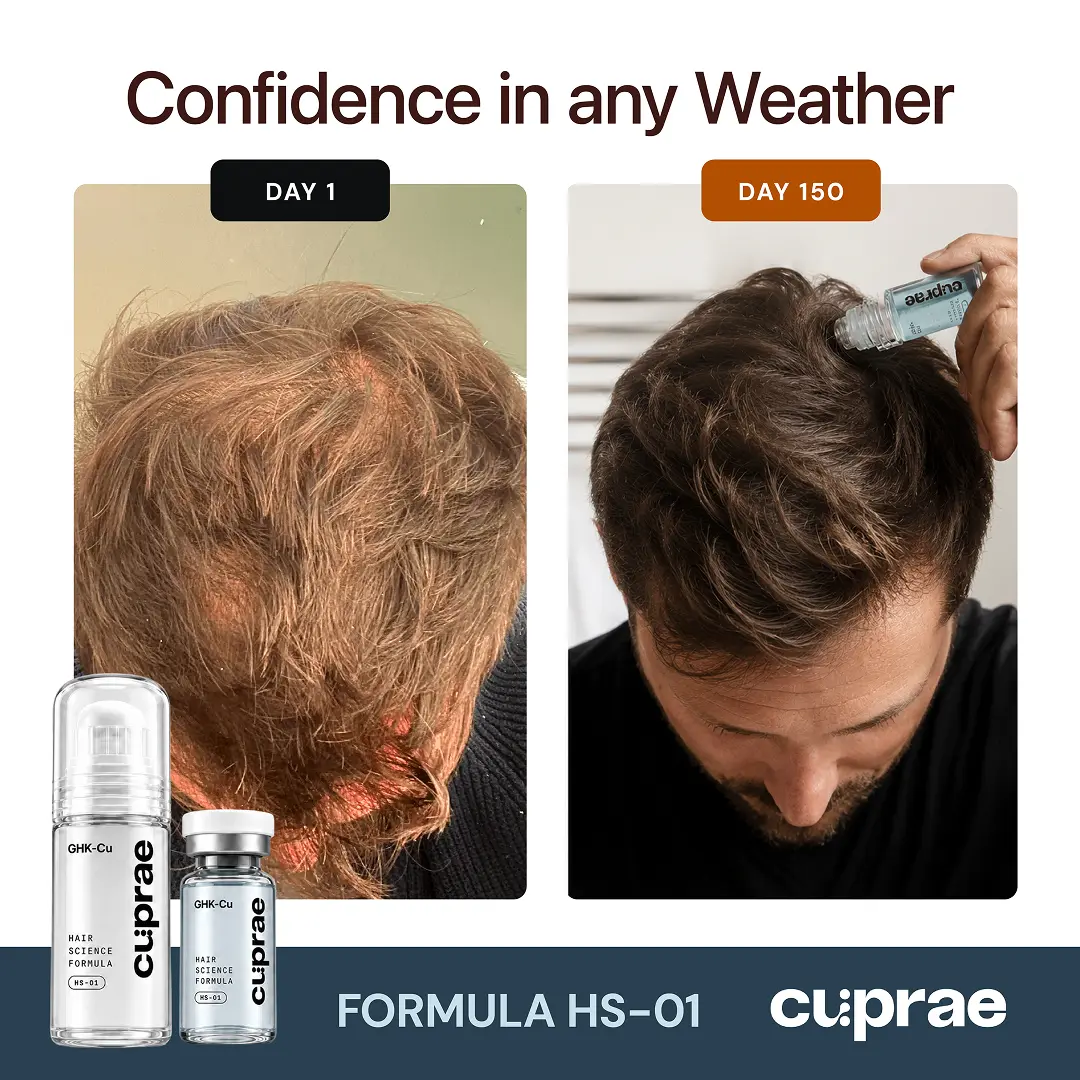 Before and after hair results