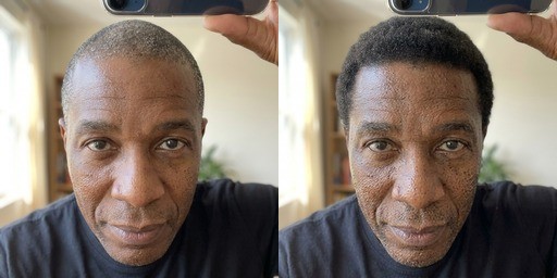 Frank W. — temple regrowth at week 8